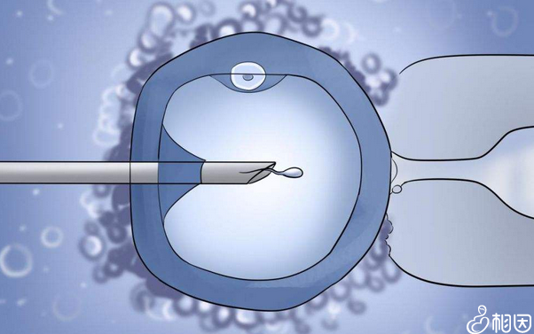 海淀妇幼试管婴儿流程解析